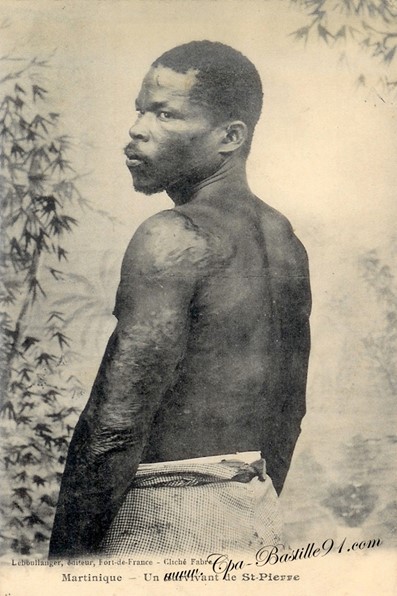 Louis-Auguste Cyparis, l’homme qui a survécu à la fin du monde